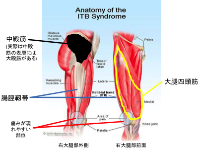 腸脛靱帯炎の誘因となる筋力および下肢動作的要因